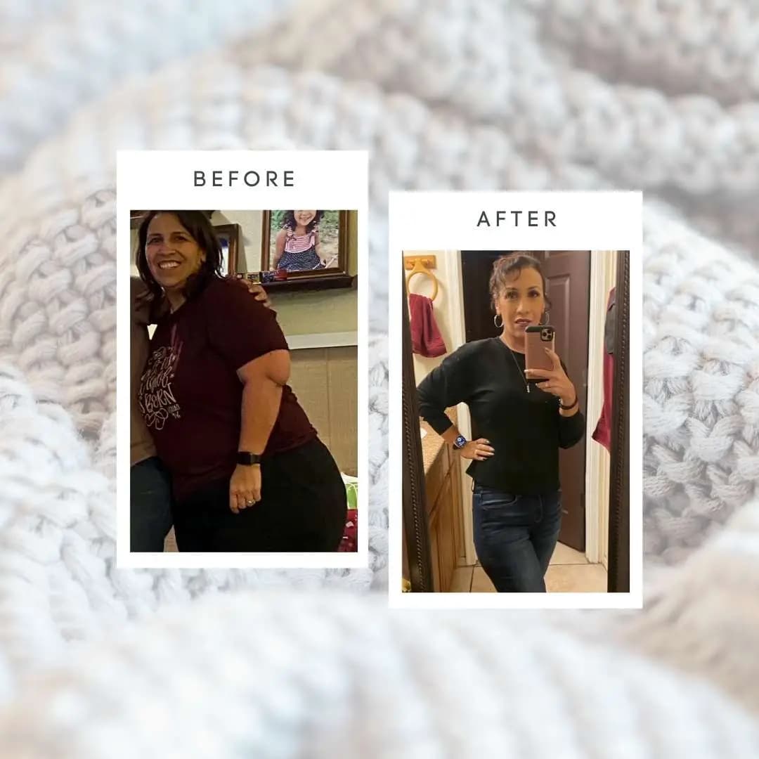 Success after bariatric surgery - patient results at Pound of Cure Weight Loss in Tucson