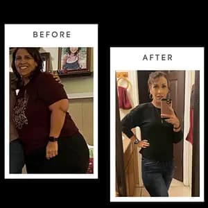 Before and after bariatric surgery results - Melissa, Tucson, Arizona