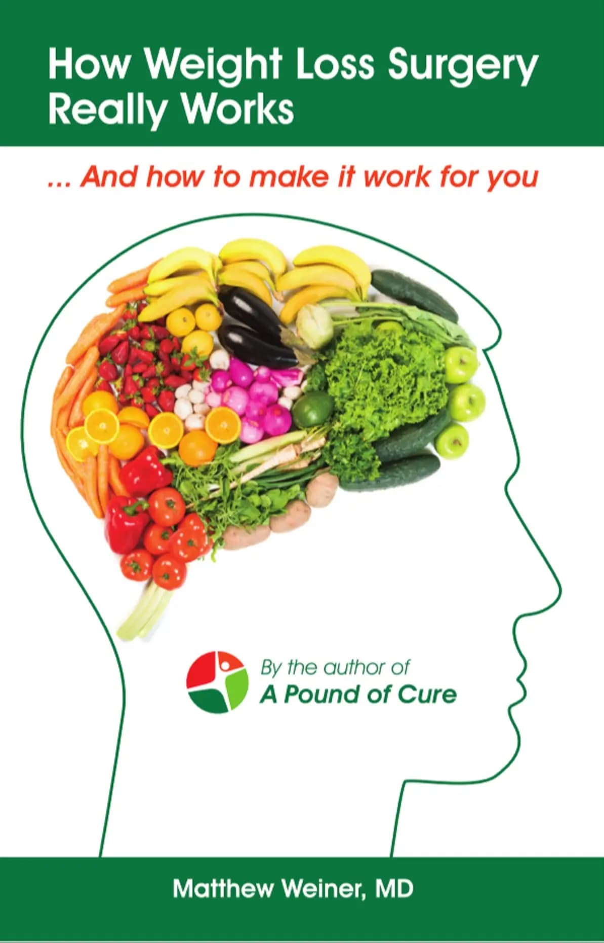 How Weight Loss Surgery Really Works - book by Dr. Matthew Weiner