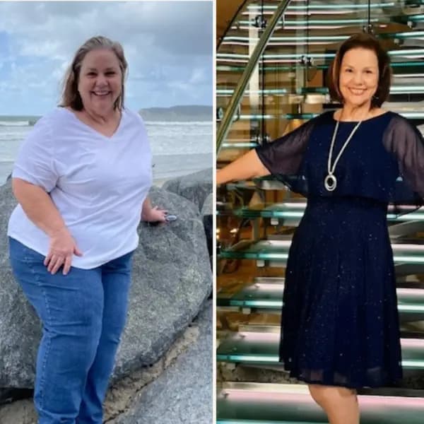 Patient transformation - female