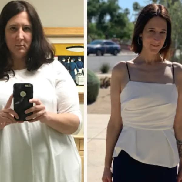 Patient transformation - female