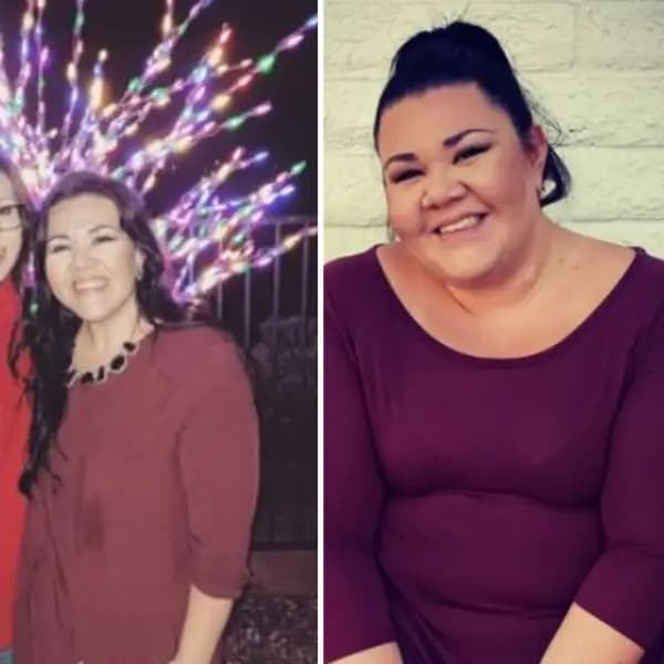 Patient transformation - female