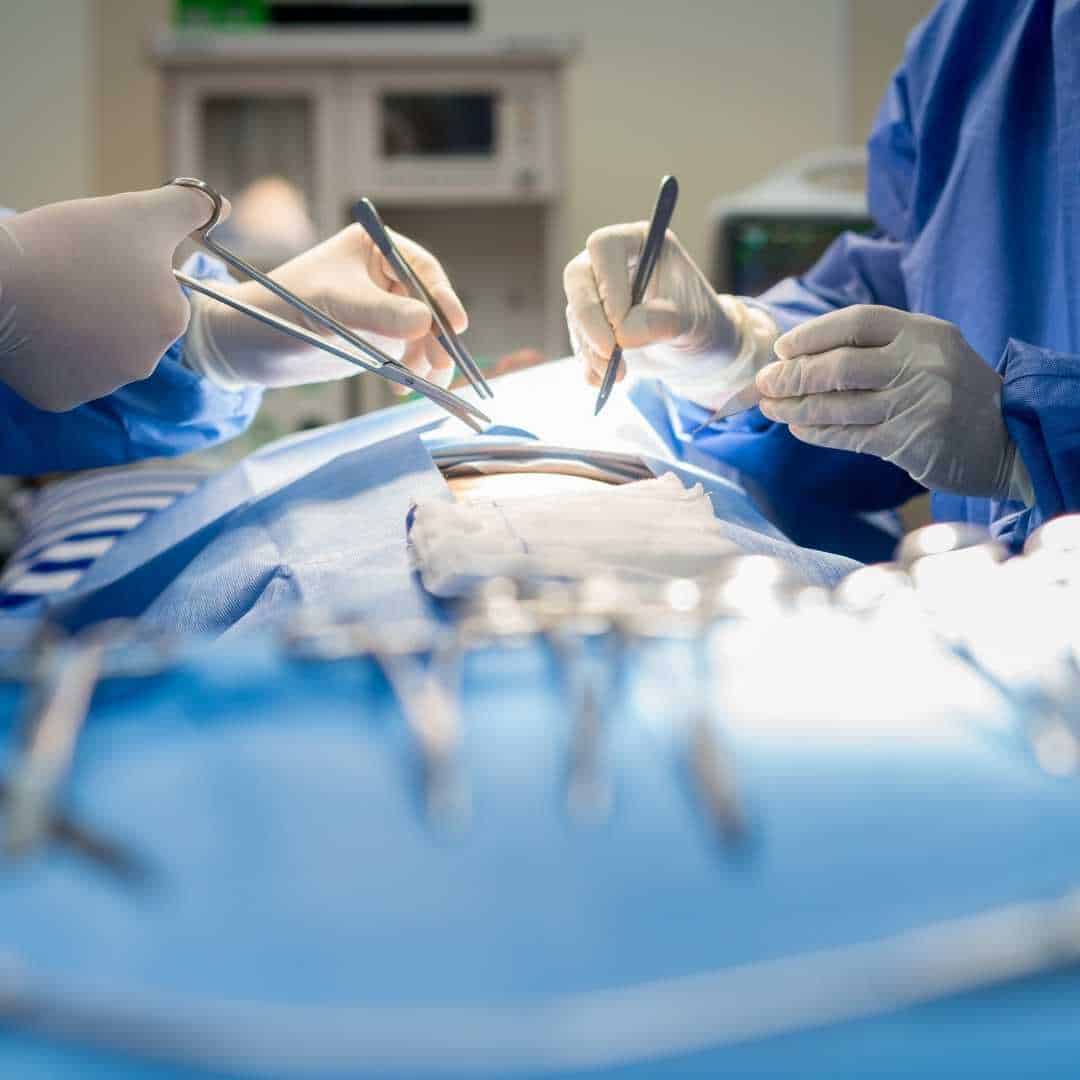 Why is there a difference in technique from surgeon to surgeon?