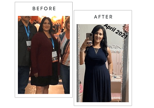 before-and-after-bariatric-surgery-1